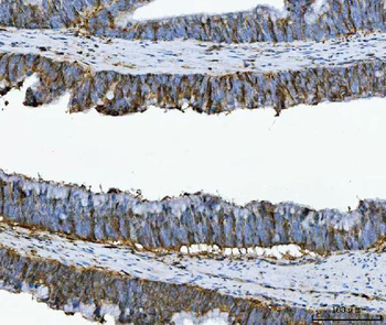 Annexin A1/ANXA1 Mouse Monoclonal Antibody