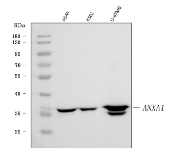 Annexin A1/ANXA1 Mouse Monoclonal Antibody