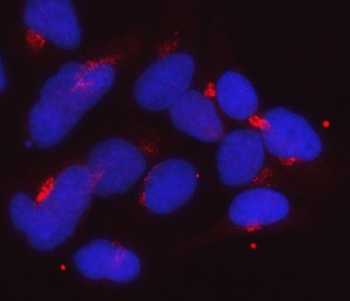Golgin 97/GOLGA1 Mouse Monoclonal Antibody
