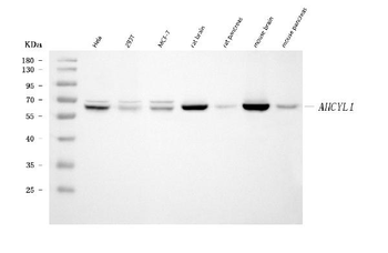 IRBIT/AHCYL1 Mouse Monoclonal Antibody