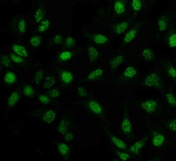 Pin1 Mouse Monoclonal Antibody