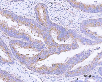 PITPNB Rabbit Polyclonal Antibody