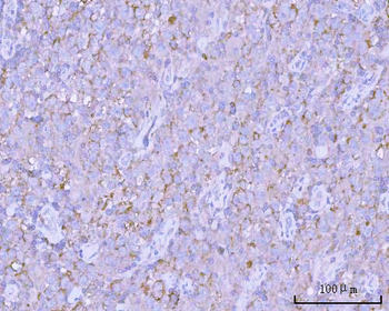 PITPNB Rabbit Polyclonal Antibody