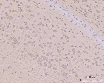 PITPNB Rabbit Polyclonal Antibody