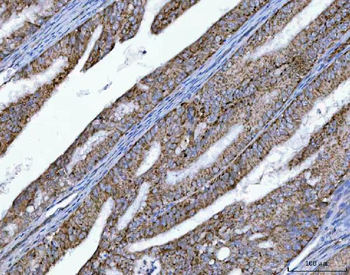 OXSM Rabbit Polyclonal Antibody