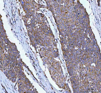 OXSM Rabbit Polyclonal Antibody