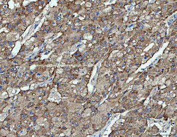 OXSM Rabbit Polyclonal Antibody