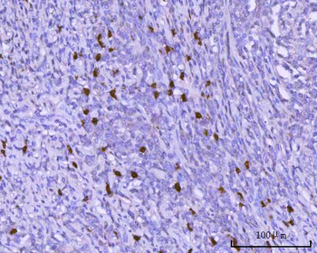 BSAP/PAX5 Rabbit Polyclonal Antibody