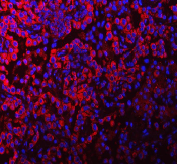 PACSIN2 Rabbit Polyclonal Antibody