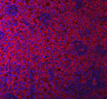 PACSIN2 Rabbit Polyclonal Antibody