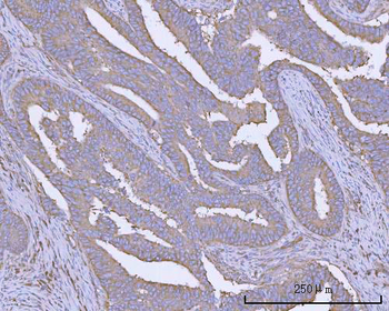 PACSIN2 Rabbit Polyclonal Antibody