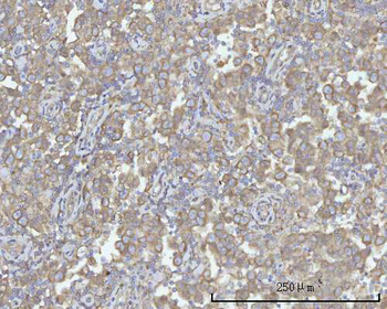 PACSIN2 Rabbit Polyclonal Antibody