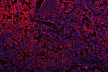 OSGIN1 Rabbit Polyclonal Antibody