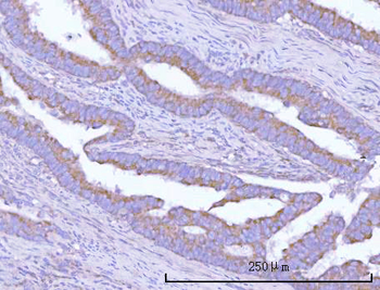 OSGIN1 Rabbit Polyclonal Antibody