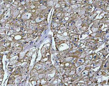 OSGIN1 Rabbit Polyclonal Antibody
