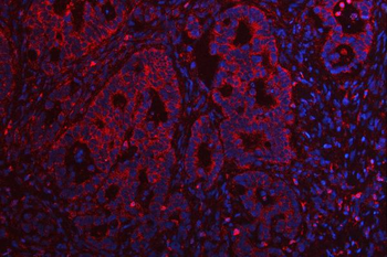 TMEM132B Rabbit Polyclonal Antibody