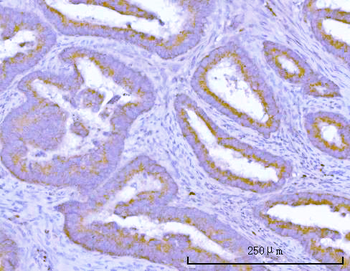 TMEM132B Rabbit Polyclonal Antibody