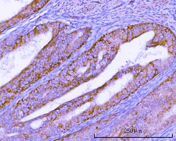 TMEM132B Rabbit Polyclonal Antibody