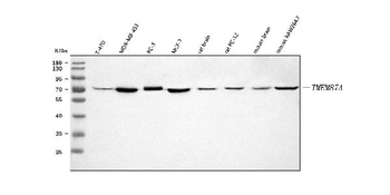 TMEM87A Rabbit Polyclonal Antibody