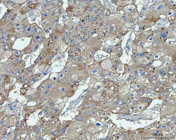 TMEM87A Rabbit Polyclonal Antibody