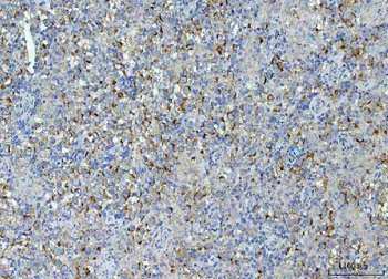 TMEM87A Rabbit Polyclonal Antibody