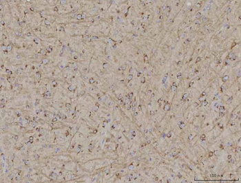 TMEM87A Rabbit Polyclonal Antibody