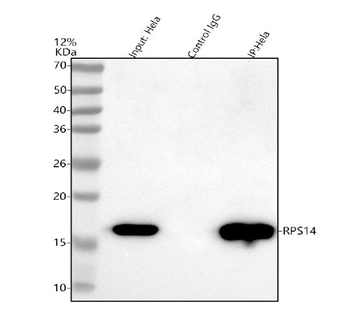 RPS14 Antibody