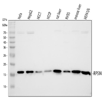 RPS14 Antibody