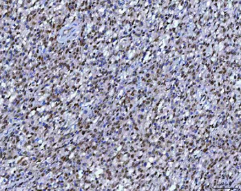 RPRD1B Rabbit Polyclonal Antibody