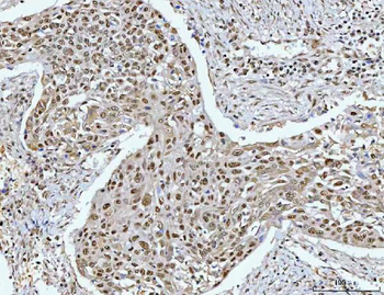 RPRD1B Rabbit Polyclonal Antibody