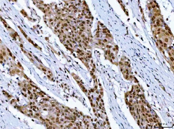 RPRD1B Rabbit Polyclonal Antibody