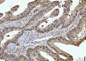 RPRD1B Rabbit Polyclonal Antibody