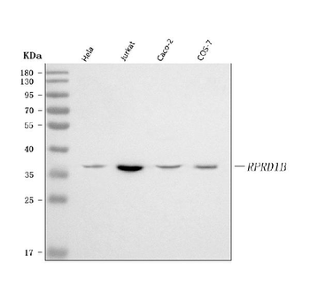 RPRD1B Rabbit Polyclonal Antibody