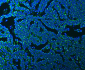 SSBP1 Rabbit Polyclonal Antibody