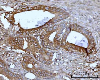 SSBP1 Rabbit Polyclonal Antibody