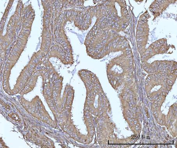 SSBP1 Rabbit Polyclonal Antibody