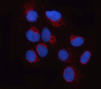OPA1 Rabbit Polyclonal Antibody