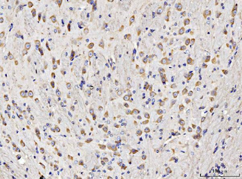 RPL11 Rabbit Polyclonal Antibody