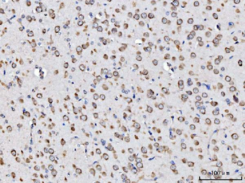 RPL11 Rabbit Polyclonal Antibody
