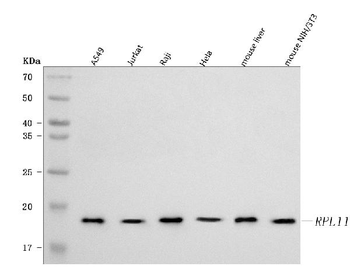 RPL11 Rabbit Polyclonal Antibody