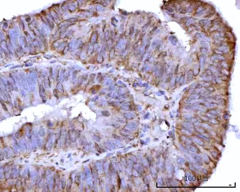 RPS25 Rabbit Polyclonal Antibody