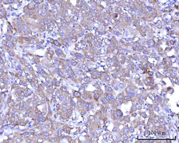 RPS25 Rabbit Polyclonal Antibody
