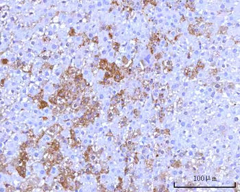 RPS25 Rabbit Polyclonal Antibody
