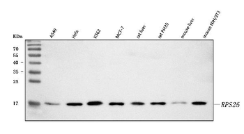 RPS25 Rabbit Polyclonal Antibody