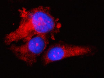 RPS17 Rabbit Polyclonal Antibody