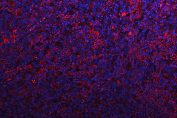 RPS15A Rabbit Polyclonal Antibody