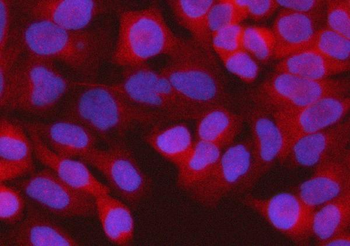 RPS15A Rabbit Polyclonal Antibody