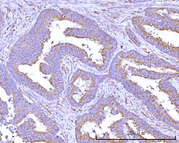 RPS15A Rabbit Polyclonal Antibody