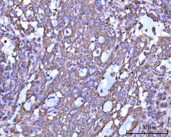 RPS14 Antibody