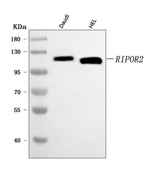 FAM65B/RIPOR2 Rabbit Polyclonal Antibody